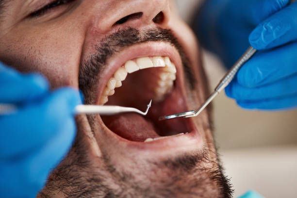 Best Broken or Cracked Tooth Emergency Dentist in Lutherville, MD