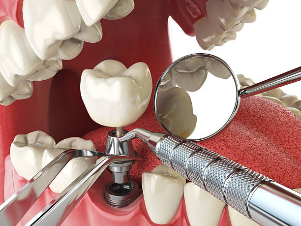 Best Emergency Dental Services for Seniors in Lutherville, MD