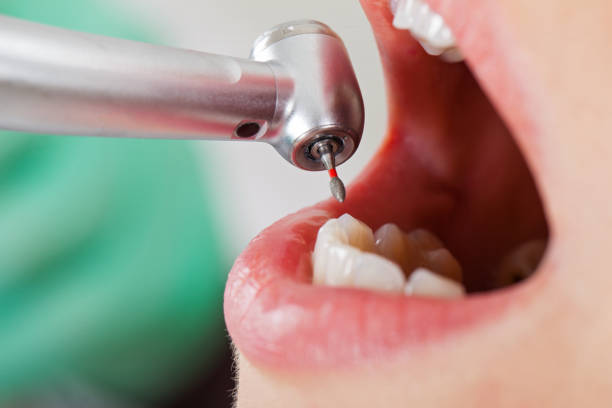 Best Weekend Emergency Dentist in Lutherville, MD